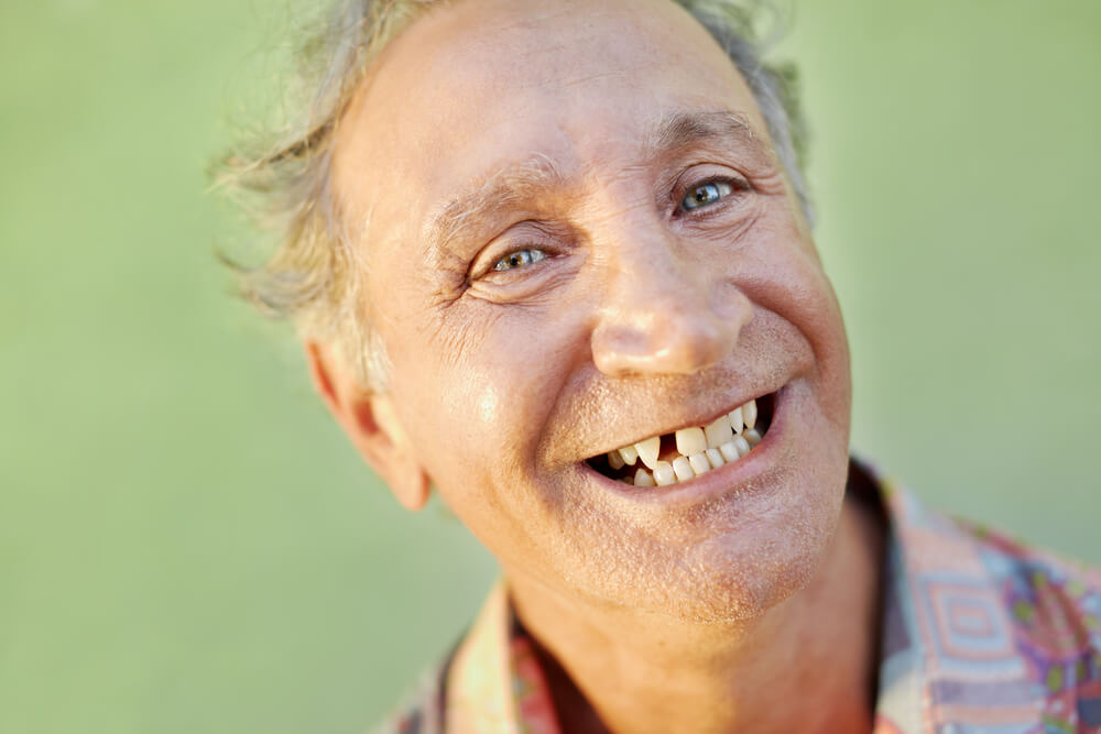 portrait of senior caucasian man with dental problems showing missing tooth and smiling.
